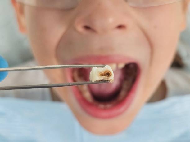 Best Cosmetic Emergency Dentistry in Ainaloa, HI